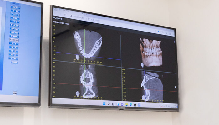 歯科用CT