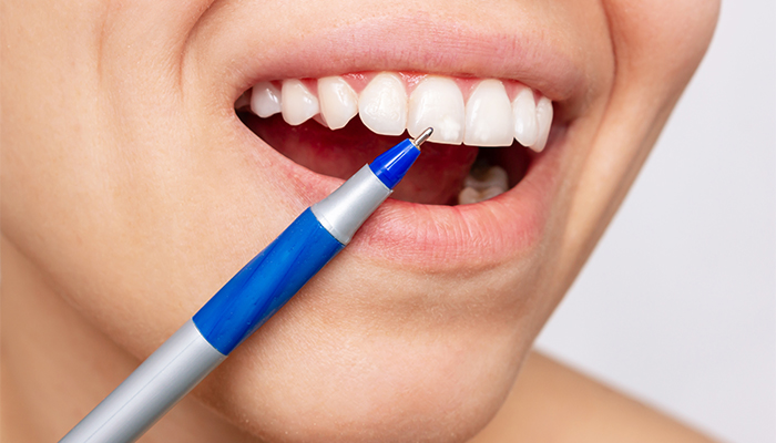 ホワイトスポットとは